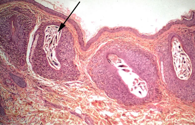 картинка демодекоза, вирусы, клетки, схема строения
